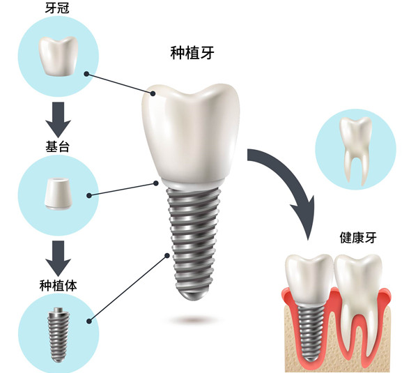 固原黃錢口腔診所