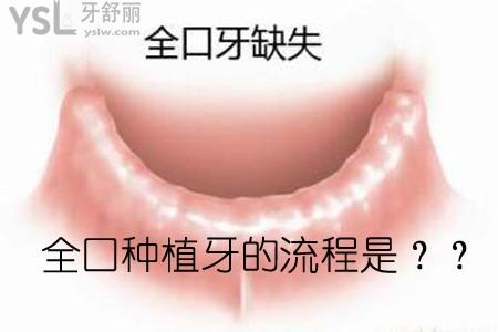 edb7831bec7b4e10a057cfcb6b21d299_副本.jpg