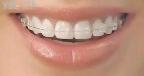 13-1Z30410451C06.jpg