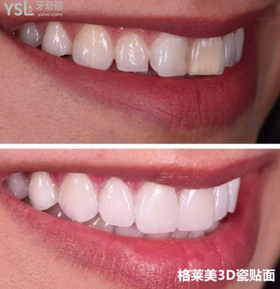 {36EB70AE-E894-4209-BEB1-DE9EA64BDDB9}_20200426180012_副本.jpg