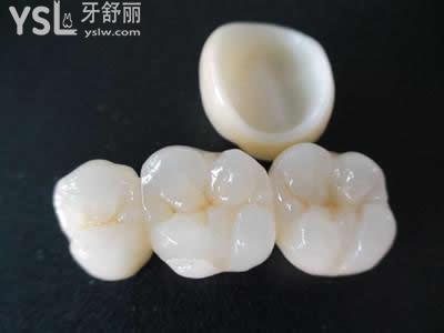 氧化鋯烤瓷牙的優(yōu)缺點(diǎn)？