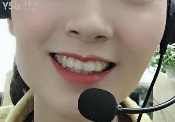帶牙套后悔一輩子，我覺得不帶牙套才會后悔