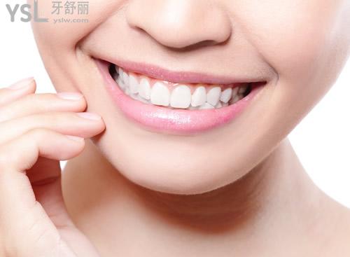 陶瓷自鎖托槽矯正優(yōu)點：