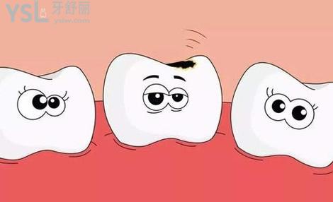 為什全瓷牙這么貴？