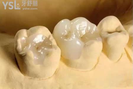 樹脂補(bǔ)牙后需要注意什么？