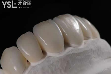 全瓷牙的優(yōu)點？