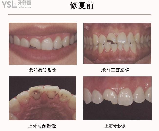 銀川和仁堂口腔牙齒修復(fù)