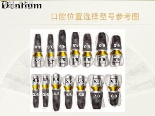 韓國登騰種植牙