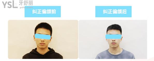 矯正1 (2).jpg