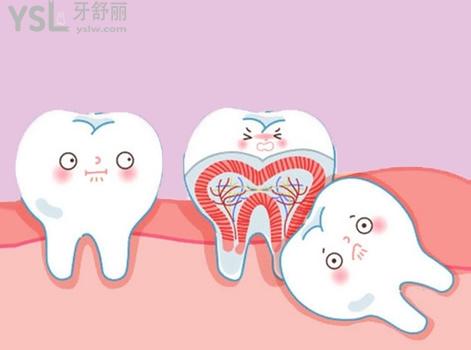 拔智齒后悔死了是真的嗎，拔智齒會很疼嗎？