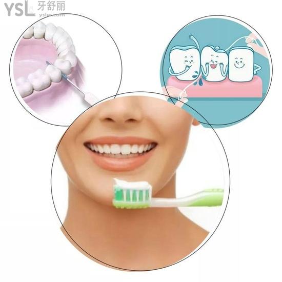 防治牙齒松動(dòng)衛(wèi)生習(xí)慣要保持好