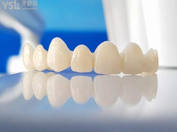 陶瓷材質(zhì)假牙