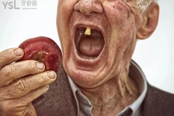 細(xì)數(shù)牙齒缺失的危害有哪些