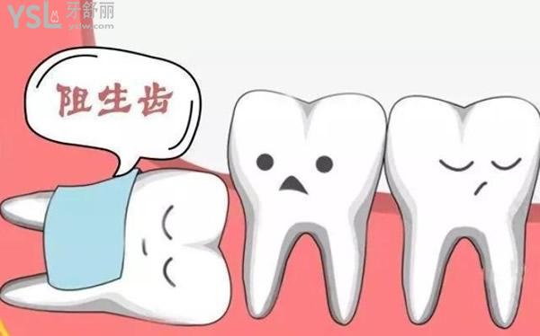 阻生齒卡通圖
