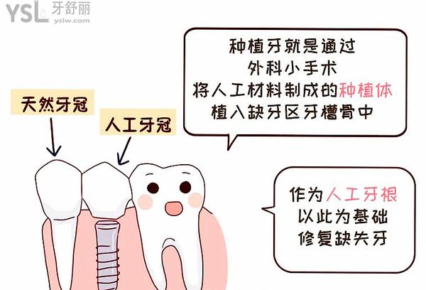 種植牙既然這么火，那種植牙人老了有沒(méi)有弊端？
