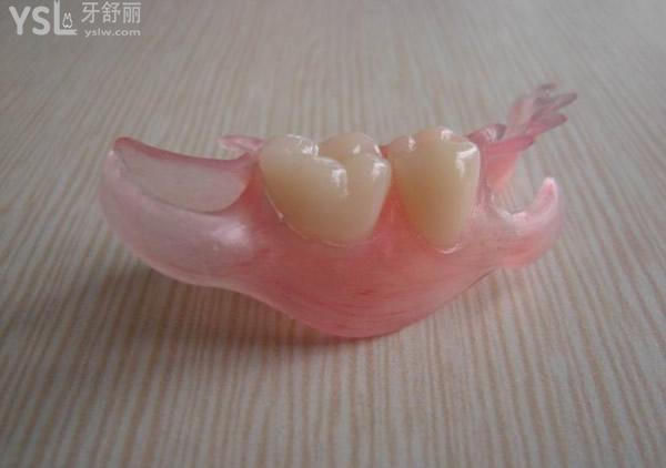 臨時(shí)活動(dòng)假牙圖片