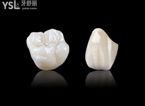 1000元的全瓷牙和1500的區(qū)別大嗎，3000元又如何？來看！