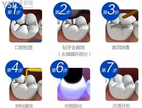 補(bǔ)牙流程圖