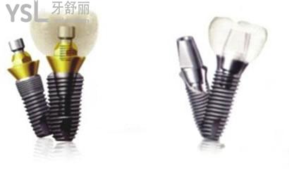 韓國(guó)登騰種植牙多少錢一顆，3900元一顆靠譜嗎？