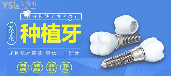 晉江金榜口腔種植牙優(yōu)勢(shì)