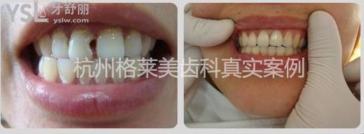 杭州格萊美口腔醫(yī)院.jpg