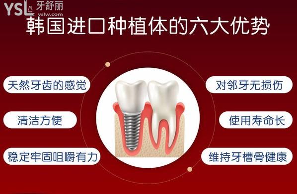 襄陽時代口腔種植牙優(yōu)勢