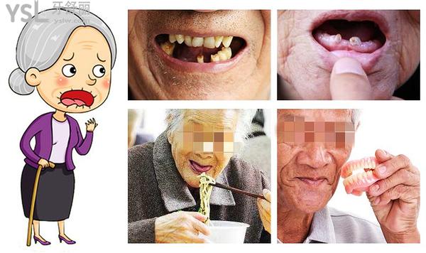 八十歲的老人還能種牙嗎？老人種牙需要什么條件？展開(kāi)說(shuō)說(shuō)