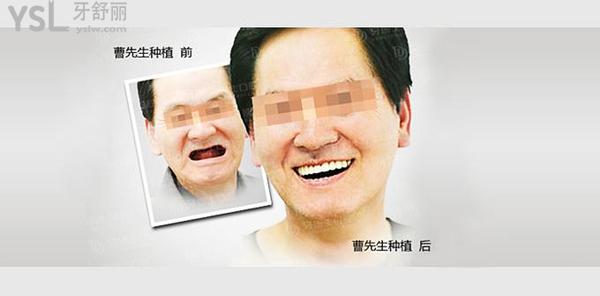 八十歲的老人還能種牙嗎？老人種牙需要什么條件？