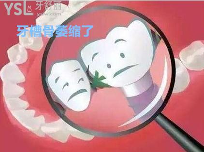 你的牙槽骨萎縮了嗎？