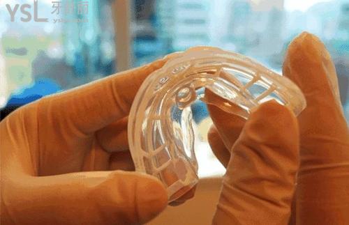 兒童mrc矯正器適合的年齡和成效情況怎么樣？牙醫(yī)揭開謎團