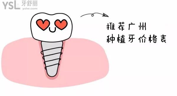 廣州種植牙價格表