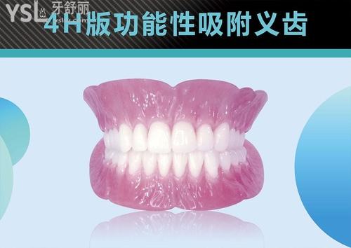 成人牙掉了可以做吸附義齒