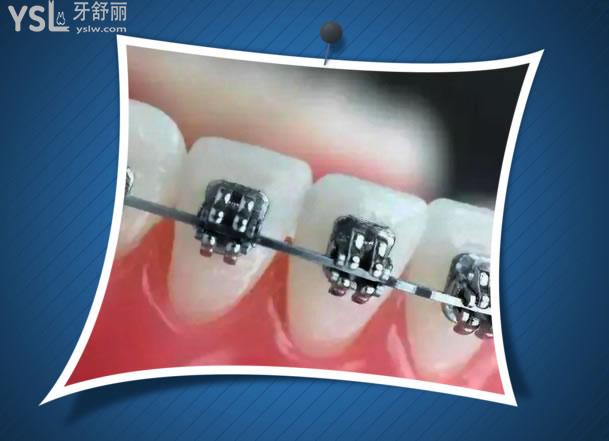 杭州齊爾口腔靠譜嗎，在這里看牙是怎樣的體驗.jpg