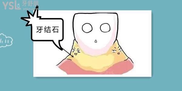 淘寶上的牙結石去除器有用嗎