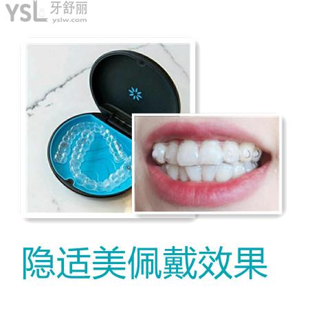 隱形矯正