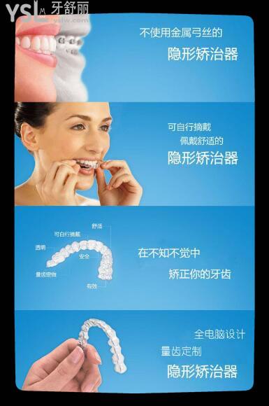 comfos隱形牙套 時(shí)代天使標(biāo)準(zhǔn)版和雙模版更適用哪些人群 這幾款性價(jià)比哪個(gè)更高.jpg