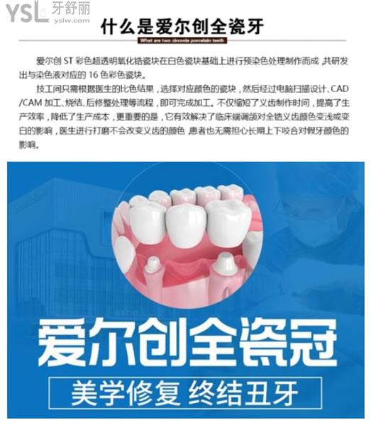 國產愛爾創(chuàng)全瓷牙