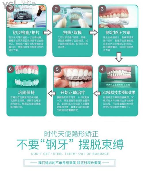 北京維恩口腔隱形矯正過程