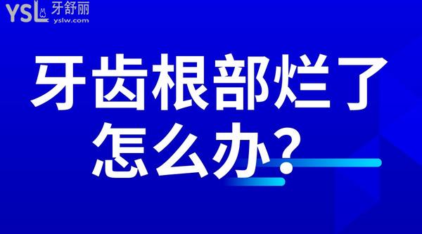 牙齒根部爛了怎么辦？