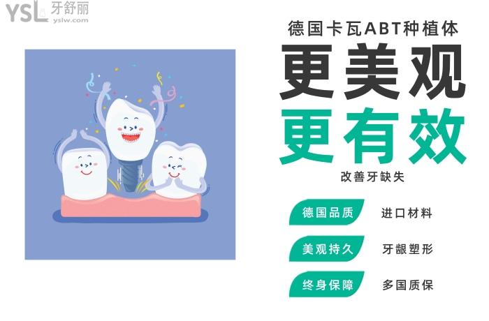 德國卡瓦ABT種植體多少錢一顆.jpg