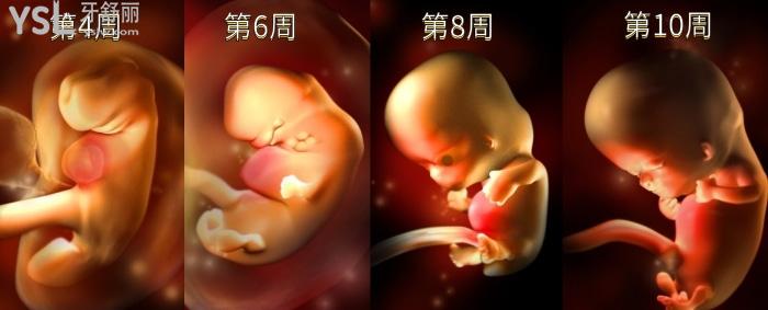腭裂唇是什么原因，如何預防？.jpg