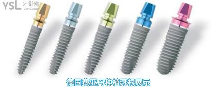 去北京西諾做德系種植牙多少錢，如何選擇種植牙告訴你.jpg