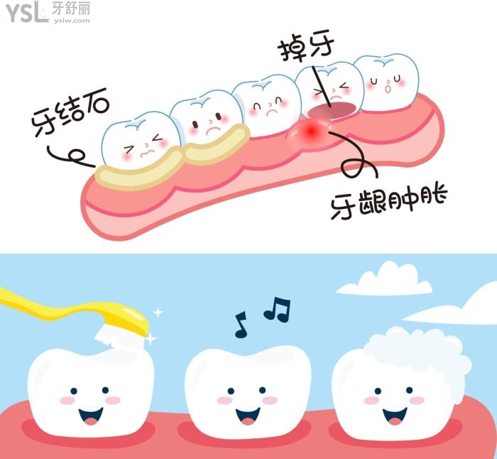 二十幾歲牙齒脫落是什么原因