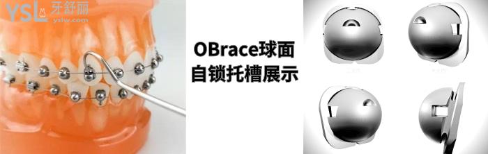 金屬自鎖和陶瓷自鎖哪個(gè)好，有哪些牌子求推薦！.jpg
