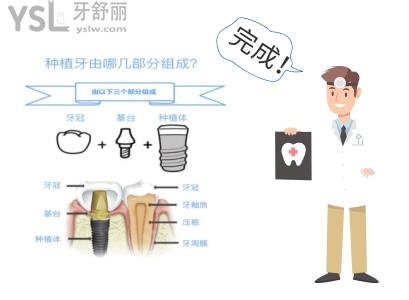 成都安假牙多少錢