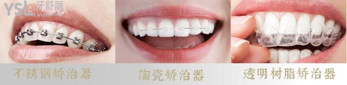 舌側(cè)矯正影響說話嗎？如何選擇矯治器呢？