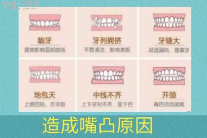 手術矯正嘴凸一般需要多少錢