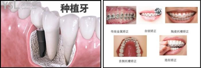 想去鞍山種植牙和矯正牙齒都比較好的口腔就來這里吧，都是本地牙科診所排名中靠前的口碑牙科