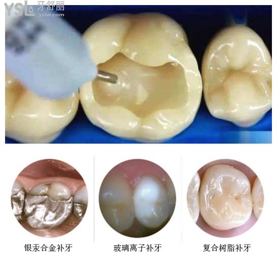 東莞看牙一般多少錢