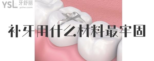 補(bǔ)牙什么材料